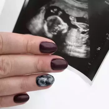 Ultrasound Nail Art